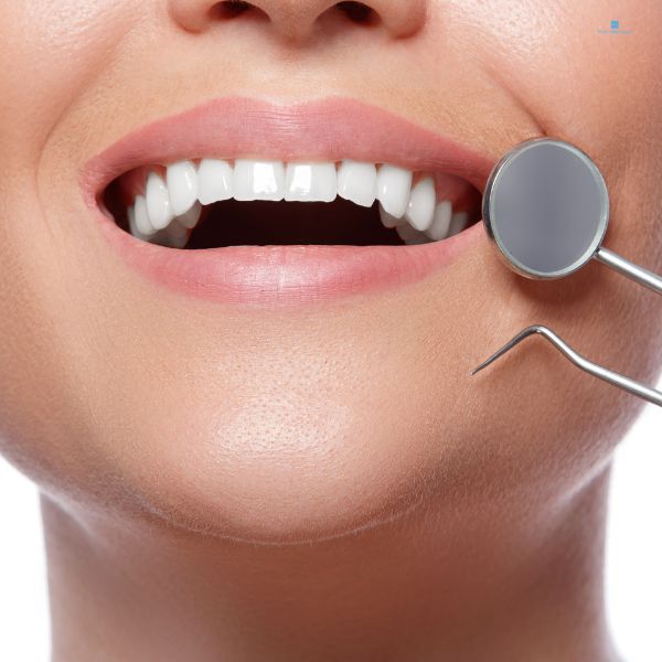 Clareamento Dental: Como é Feito e Quais os Benefícios.