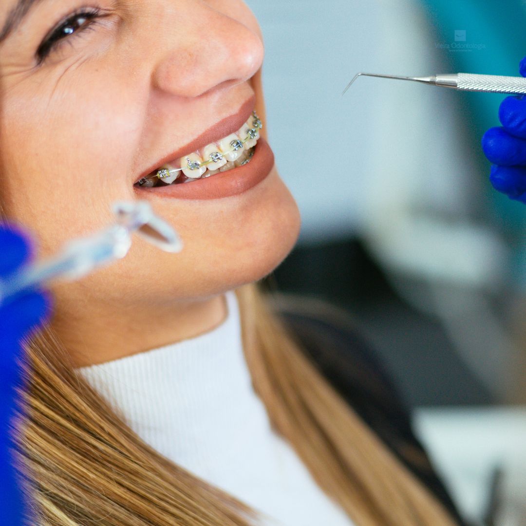 A Ortodontia é a valiosa especialidade da odontologia que atua como uma verdadeira artesã de sorrisos.