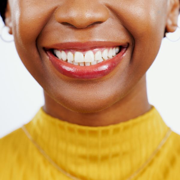 Lentes De Contato Dental: Uma Solução Estética E Funcional Para Seus Dentes.