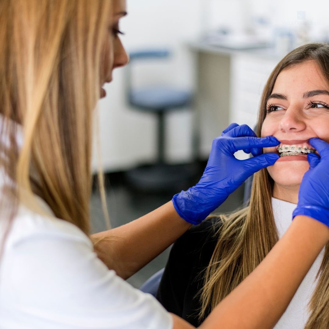 A ortodontia é uma especialidade da odontologia que se dedica ao estudo, prevenção e tratamento das irregularidades dentárias e faciais.