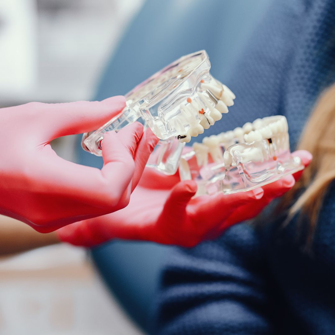 As próteses dentárias são dispositivos elaborados para substituir dentes que foram perdidos ou danificados, desempenhando um papel crucial na reabilitação oral.