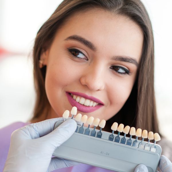 O que são Lentes de Contato Dental e como Transformam Sorrisos.