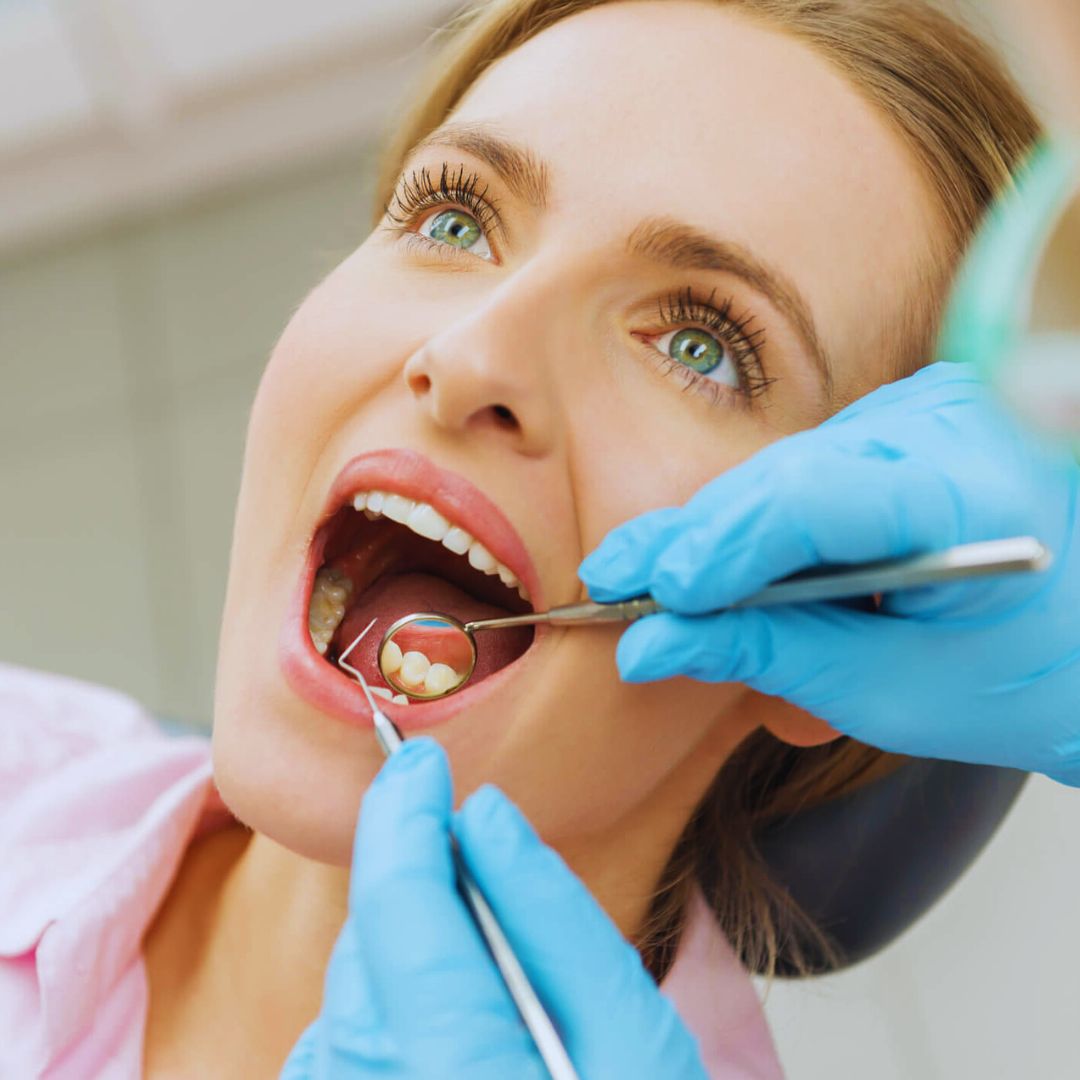 A limpeza dental não apenas remove a placa bacteriana e o tártaro, mas também atua na prevenção de doenças bucais, como cáries e gengivite.