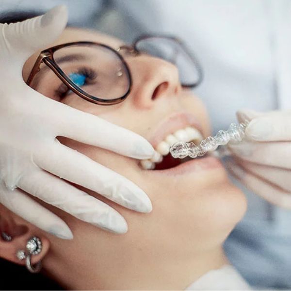 Alinhadores Ortodônticos como Solução Estética e Confortável.