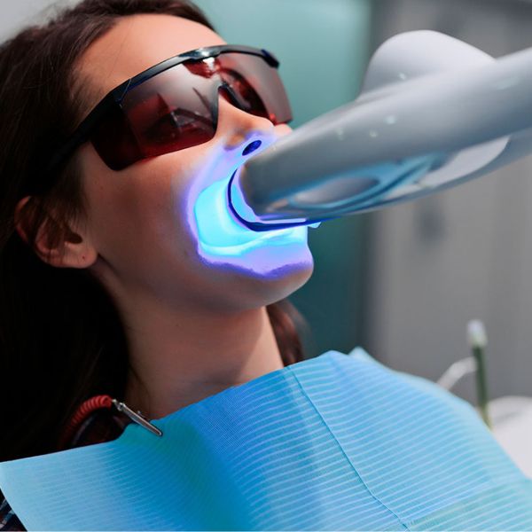 Como o Clareamento Dental pode Transformar seu Sorriso e Autoestima.