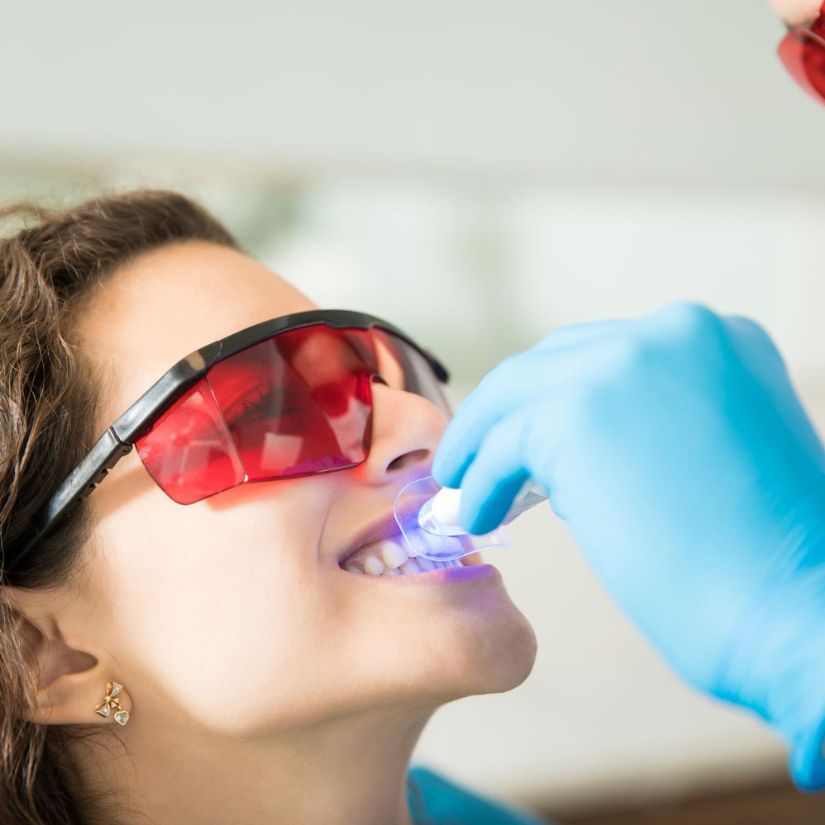 A Importância da Avaliação Profissional antes do Clareamento Dental.