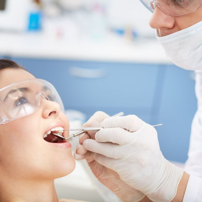 O que são Lentes de Contato Dental e como Elas podem Transformar seu Sorriso.