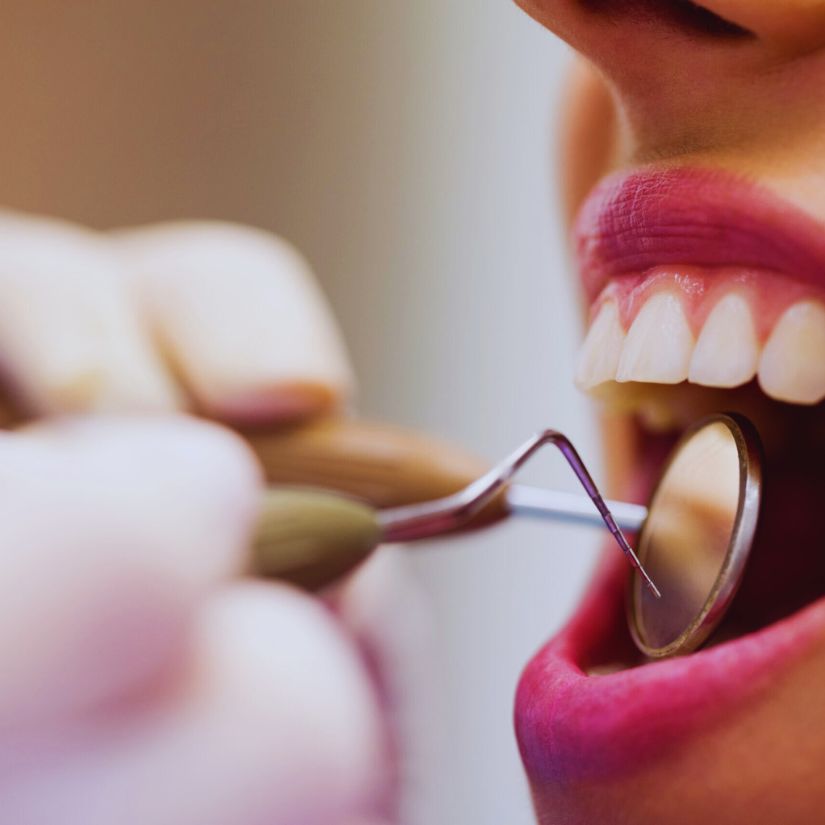 Razões para Consultar um Periodontista e Garantir a Saúde das suas Gengivas.