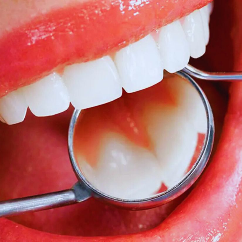 Razões para Consultar um Periodontista e Garantir a Saúde das suas Gengivas.