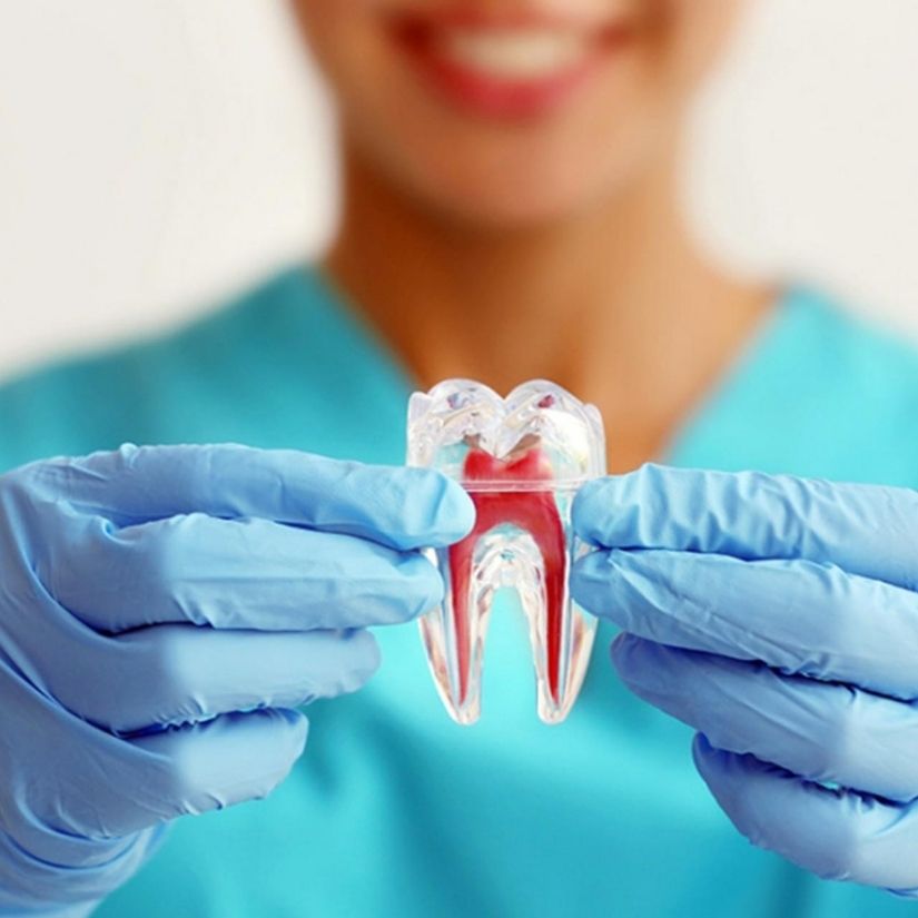 O que é a Endodontia e como ela pode Salvar seu Sorriso.