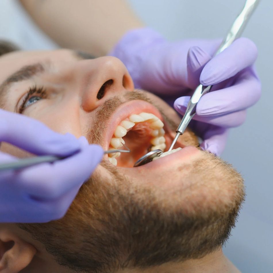 Entendendo a Osseointegração e sua Importância nos Implantes Dentários.